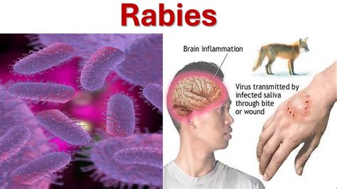 rabies mayo clinic|Rabies: Causes, Symptoms, Treatment & Prevention .